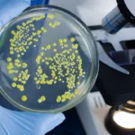 Ukrayna’da “Tedavisi İmkansız” Süper Bakteri